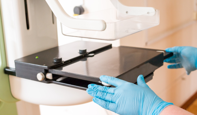 Mammographie-Lösung für PACS-Workstations